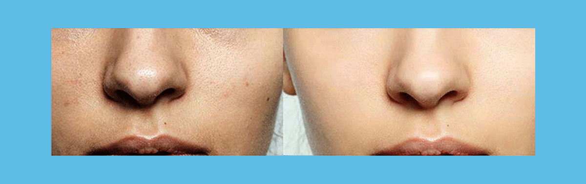 1758172106119968.gif 1.gif